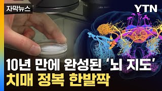 [자막뉴스] '인간 뇌' 비밀 풀리나...초파리에서 찾아낸 해답 / YTN