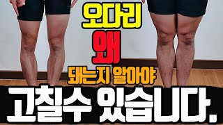 오다리교정 휜다리~이것만 알면 일자다리가 됩니다.(O다리 개선을 위한 효과적 방법 1편)