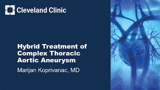 Hybrid Treatment of Complex Thoracic Aortic Aneurysm (Graphic)