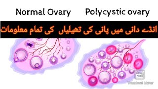 Polycystic ovary Syndrome in urdu || #PCOS cause || @talkabouthealth9675