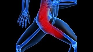 Cure Sciatica Naturally In 7 Days Best Natural Sciatica Treatment
