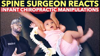 Spine Surgeon Reacts to INFANT Chiropractic Manipulations