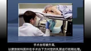 UCSF Radiology: Mammogram-Guided Breast Biopsy (Mandarin Chinese)