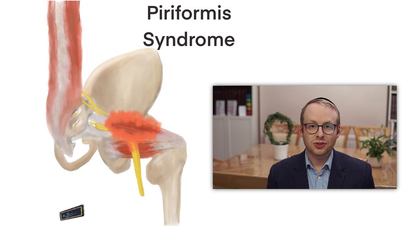 Piriformis Syndrome - YouTube