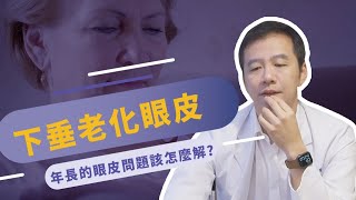 割雙眼皮 縫雙眼皮？ 母親節的禮物好選擇！解決媽媽們的眼皮小煩惱｜【整聊室 張峯瑞醫師】