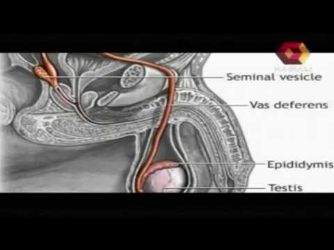 Vandhyathayude Kanappurangal | Premature Ejaculation | 28 09 2013 | Part 2 Vandhyathayude Kanappurangal | Premature Ejaculation | 28 09 2013 | Part 2