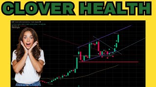 🔥 Clover Health CLOV Stock: This Chart Looks Absolutely Stunning! 📈