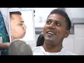 Indian Chin Surgery (Genioplasty) - Before & After Surgery Transformation