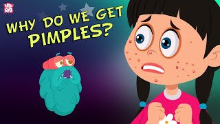 Why Do We Get Pimples? The Dr. Binocs Show | Best Learning Videos For Kids | Peekaboo Kidz