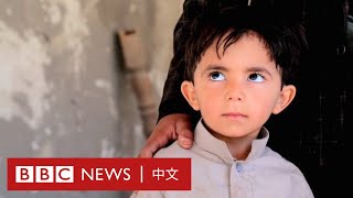 葉門「被遺忘的戰爭」：八年持續戰亂 上月700多次空襲－ BBC News 中文