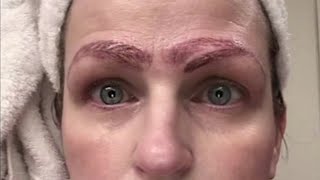 Woman Left With 4 Eyebrows After Microblading Treatment Goes Horribly Wrong