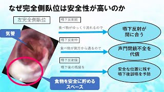 3分でわかる【完全側臥位法】　～口から食べ続けるために～　重度嚥下障害の方でもむせずに食べられる