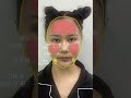 老公因为我馒化脸不回家！再看看现在的我？回不回家重要吗？ plasticsurgery cosmeticsurgery facialrejuvenation