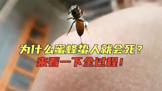 蜜蜂蛰人后为什么会死？来看下全过程！