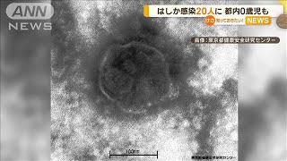 全国ではしか感染20人に　都内では0歳児も【知っておきたい！】【グッド！モーニング】(2024年3月25日)