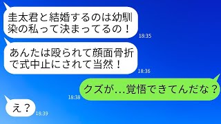 私がヤクザの組長の娘だと知らずに結婚式の日に殴られて顔面骨折させた夫の幼馴染の女性「彼を奪った罰よw」→式を中止させて喜ぶ女性に厳しい制裁を加えた結果www