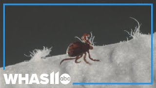 Indiana man's life takes drastic turn after tick bite