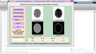 Medicinal Leaf Recognition Using Image Processing Full Matlab Project Code