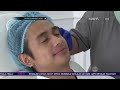 ajun perwira jalani perawatan botox rahang