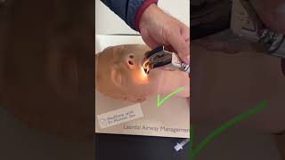 MACINTOSH BLADE INSERTION TECHNIQUE #criticalcaremedicine #emergencymedicine#airwaymanagement