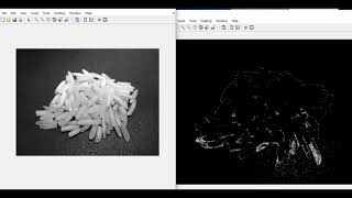 Image Processing using MATLAB - 9 - Double Thresholding