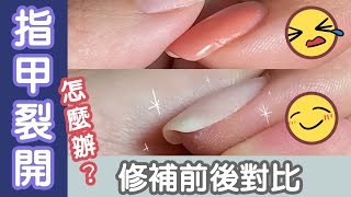 What should I do if my nails are cracked? Repairing damaged nails with gel nails