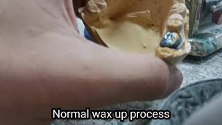 Single crowns rocking problem wax up solution