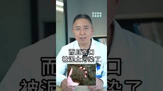 孩子在室外被划伤了，要打破伤风针吗？#医学科普 #分享健康知识 #健康科普 #打针 #诊室日常 #健康育儿 #dou来涨健康知识