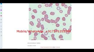 Leukemia Blood Cancer Detection Using Python Code || Leukemia Blood Cancer Identification
