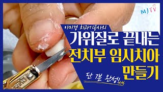 MJTV Episode 54 - dental technician's temporary tooth making team that ends with scissors!