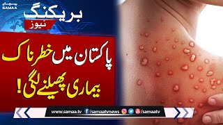 Breaking News! Monkeypox Cases increase In Pakistan | SAMAA TV