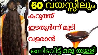 60 വയസ്സിലും കറുത്ത്  ഇടതൂർന്ന് മുടി വളരാൻ ഒന്നിടവിട്ട് ഒരു തുള്ളി 265 #fasthairgrowthremedy