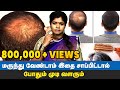 இதை பின்பற்றினா போதும் கொட்டுன முடி திரும்ப வளரும் | Hair Regrowth Tips Tamil | Dr Yogavidhya