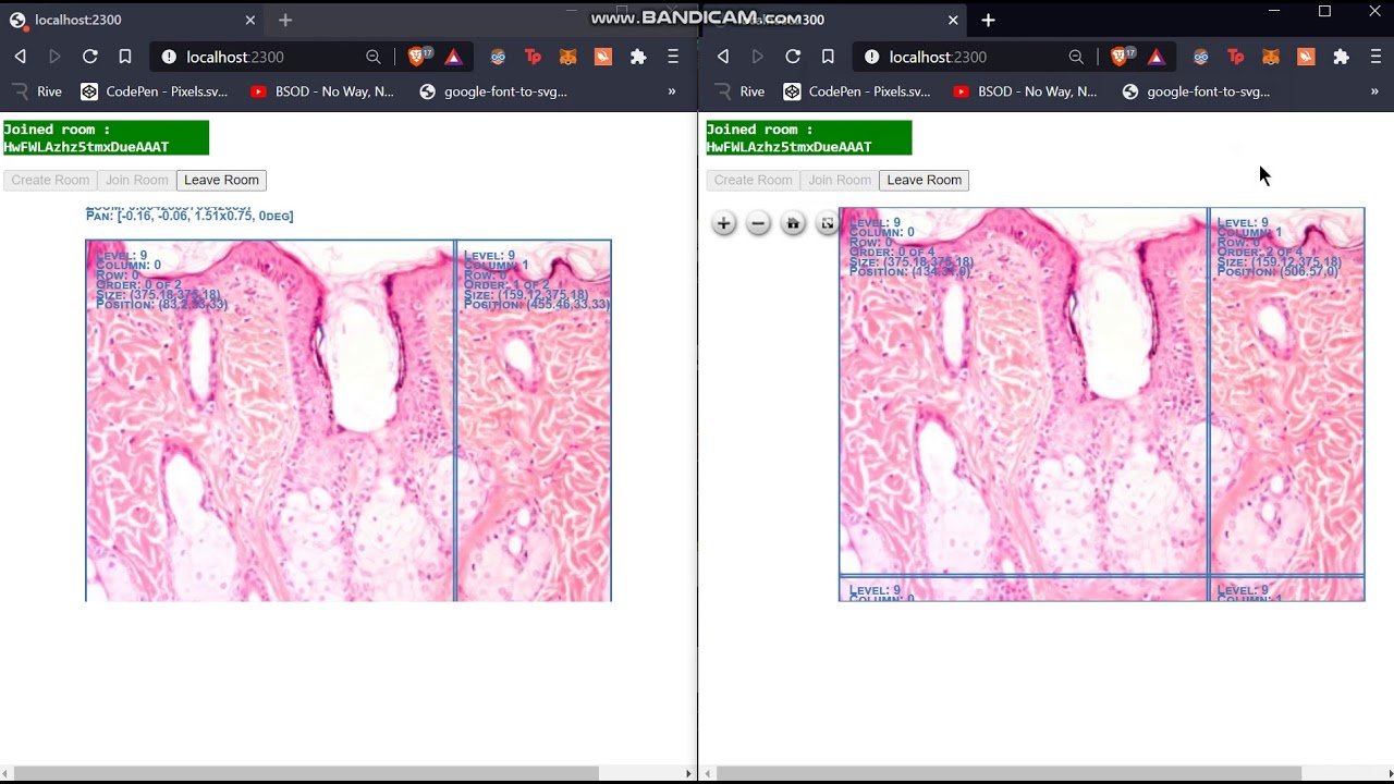 Camicroscope Real Time Slide Editing And Viewing Openseadragon Pan