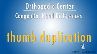 thumb duplication - congenital hand differences -  Boston Children's Hospital