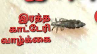 Lice life, First Time In Tamil, பேன், வாழ்க்கை வரலாறு தெரியுமா? Lice in hair removal