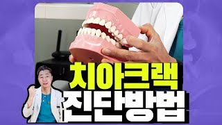 시큰한 치아통증 크랙[이빨에 금 균열]/자가진단 및 치료방법