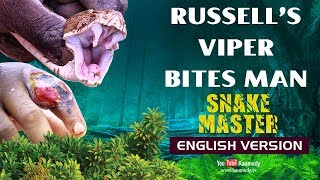 Russellโs viper bites man | Watch what happened to Roy Thomas | Snakemaster English | EP 11