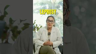 Did you know leprosy is a curable disease?