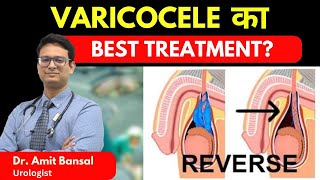 Varicocele से जुड़ी सारी Myths और FAQ's  I क्या Non-Surgical Treatment ही सबसे बढ़िया इलाज है?