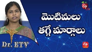 Ways To Reduce Acne | మొటిమలు తగ్గే మార్గాలు | Dr.ETV | 23rd  May 2022 | ETV Life