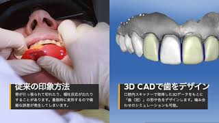 光学印象（スキャナー）、CADCAMって何？