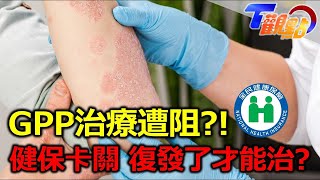 健保卡關心好累 乾癬復發才能用藥？ 常人生活成病友夢想 低油 低糖需切記 亂吃當心乾癬大爆發 T觀點 20230415 (2/4)