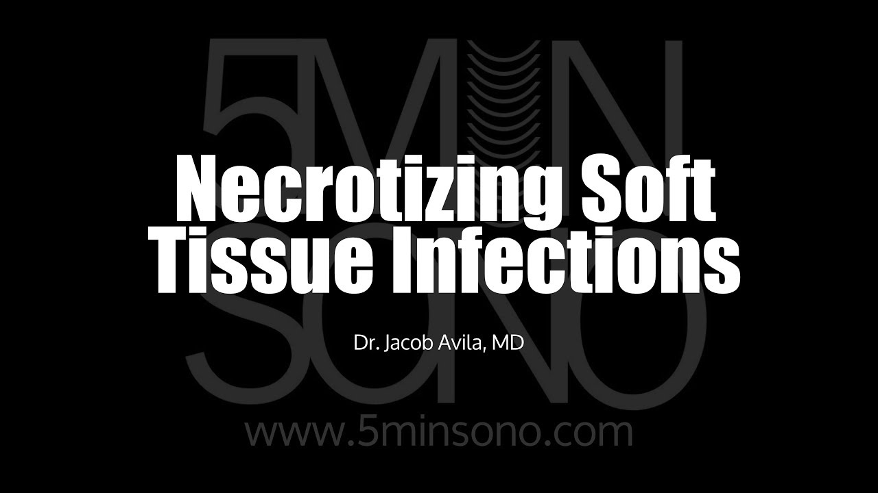 Necrotizing Soft Tissue Infection - YouTube