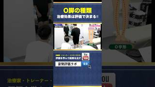 【O脚のタイプ】治療前の評価で決まる‼︎正しい評価が出来れば触るべき部位が明確になります #姿勢評価 #姿勢改善 #o脚矯正