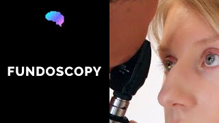 Fundoscopy (Ophthalmoscopy) - OSCE Guide | UKMLA | CPSA | PLAB 2