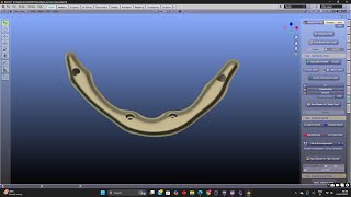 UPPER IBAR DESIGNING FOR ALL ON 4 SMU IMPLANT IN BLENDER -BEST LASER  in 5days chennai india