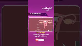 IUI ఎలా చేస్తారు తీసుకోవాల్సిన జాగ్రత్తలు ఏంటి? | IUI Process in Telugu | Oasis Fertility | #shorts