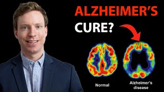 New Study: 29% Improvement In Alzheimer’s Disease?!