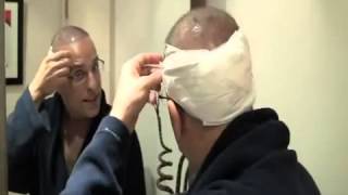 Simon Withington, DHI Hair Restoration, Step by Step #1   YouTube